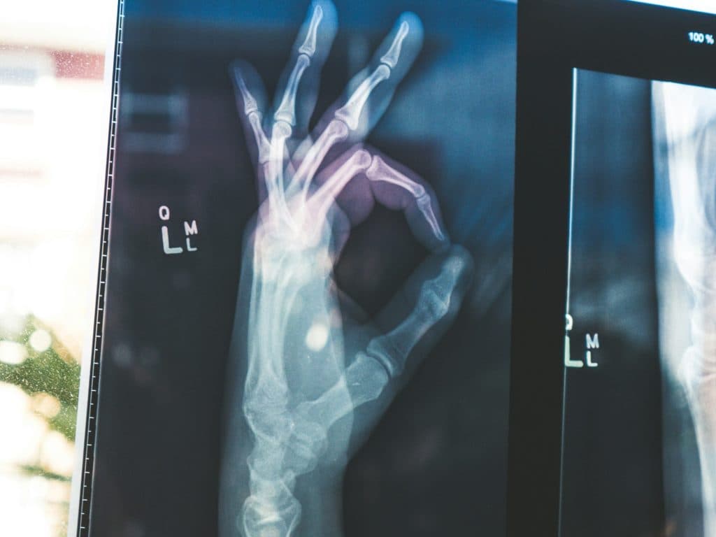 Google izdaja odprtokodne modele MedGemma za zdravstvo